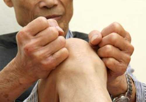 có thể do thoái hóa khớp